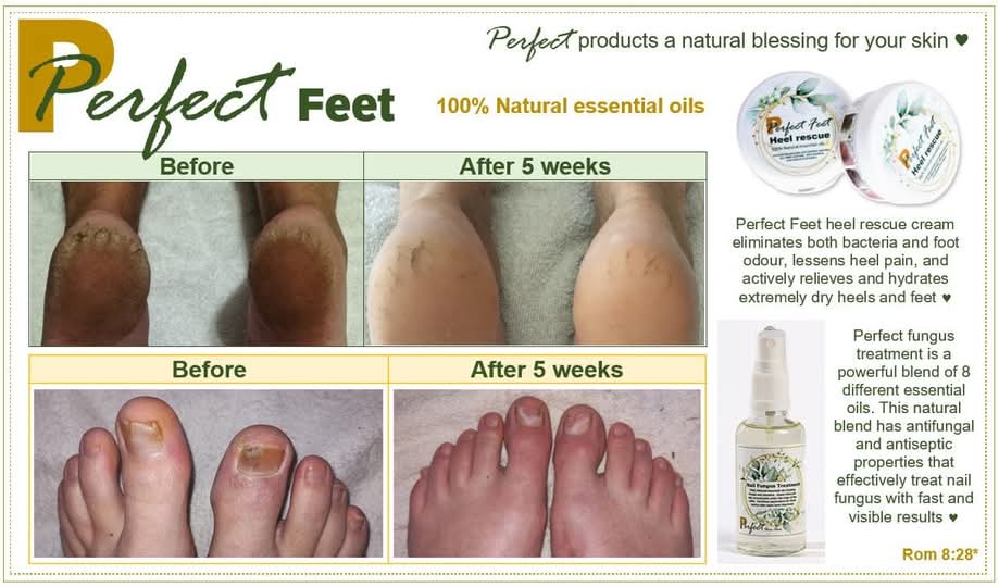 Perfect Feet - Nail Fungus Spray