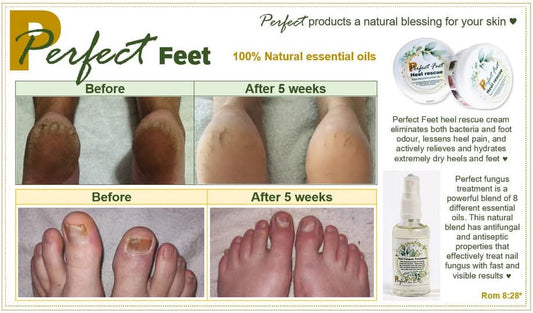 Perfect Feet - Nail Fungus Spray